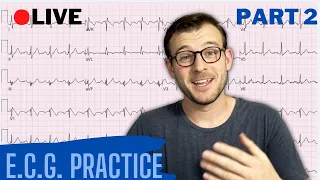 🔴ECG's for Emergency Physicians (Dr Syl's Study Stream) - PART 2