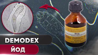 Йод против клеща | Угревая Железница Demodex