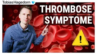 Thrombose/Blutgerinnsel Gefahr 🩸 - Bei diesen Symptomen sofort zum Arzt!