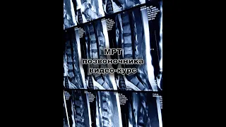 МРТ позвоночника(видео-курс)
