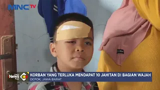 GEGER! Bocah di Cipayung Depok Diserang Monyet Liar, Korban Dicakar dan Digigit di Wajah - LIP 10/10