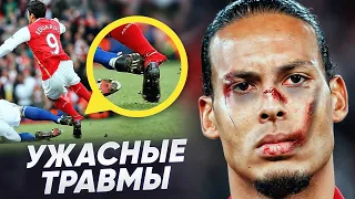 САМЫЕ УЖАСНЫЕ ТРАВМЫ В ИСТОРИИ АПЛ. ЖУТКИЕ ТРАВМЫ ФУТБОЛИСТОВ - GOAL24