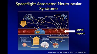 MPFF to protect venous & lymphatic function in weightlessness | Dr. Monika Gloviczki | IHS 2022