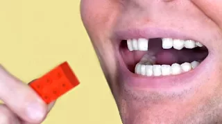 LEGO TOY BREAKS TOOTH!