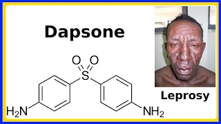 dapsone