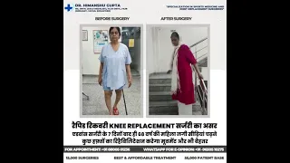 68 year woman get rapid recovery and started climbing stair in 7 days after Advance Knee Replacement