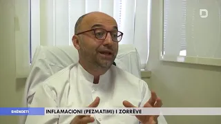 Inflamacioni (Pezmatimi) i zorrëve, Dr. Visar Berisha - Spitali Amerikan Prishtinë