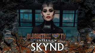 SKYND "PEOPLE DON'T KNOW WHAT TO EXPECT FROM ME