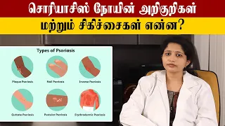 Psoriasis Symptoms And Treatment Tamil | சொரியாசிஸ் குணப்படுத்துவது எப்படி?