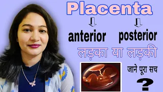 Placenta anterior और posterior होने से गर्भ में लड़का या लड़की का पता लगाया जा सकता है ! myths/truth