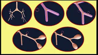 Maturation of Lung - Surfactant - Respiratory Distress Syndrome - Respiratory System Embryology