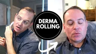 DERMA ROLLING & A DAY IN SCARBOROUGH | THE LODGE GUYS | VLOG