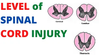 Spinal Cord Injury | Levels of Injury