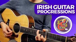 Irish Music Guitar Lesson #1 [Playing Reels] Start Today