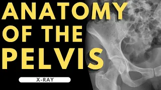 Pelvis Anatomy | Radiology anatomy part 1 prep | Pelvic X-ray interpretation