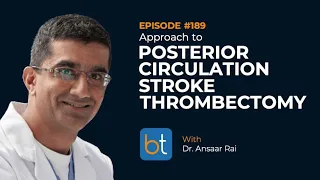 Posterior Circulation Stroke Thrombectomy w/ Dr. Ansaar Rai | BackTable Podcast Ep. 189