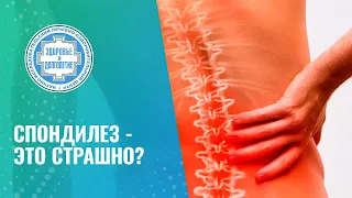 🤷 Спондилез - это страшно?