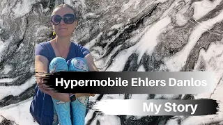 Hypermobile Ehlers Danlos Syndrome:My Story