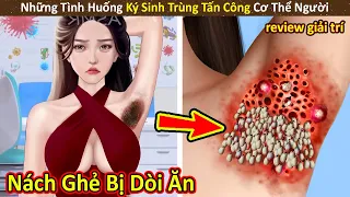 Nhím Cute Review Những Trường Hợp Con Người Bị Ký Sinh Trùng Xâm Nhập P28|| Review Giải Trí Đời Sống