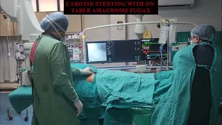Carotid Stenting with on Table Amaurosis Fugax | #irfacilities #health #stenting #carotid #coiling