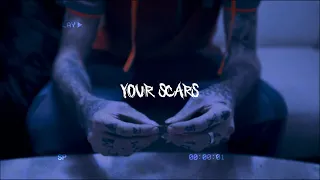 [FREE FOR PROFIT] LIL PEEP X EMO TRAP TYPE BEAT – "YOUR SCARS"