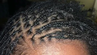 Starter Locs they take half the time as sister locks and achieve the same results