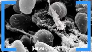 Oregon has confirmed state's first bubonic plague case since 2015 | NewsNation Live