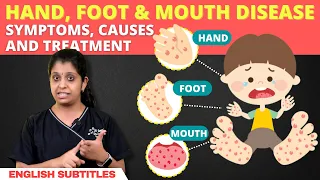 Hand, Foot, and Mouth Disease - How Dangerous Is It👶குழந்தைகளை இந்த நோயிலிருந்து எப்படி பாதுகாப்பது?