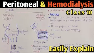 Dialysis | Peritoneal And Hemodialysis | Class 10 Biology