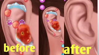 Asmr ear treatment and safe .3d animation ear infection Care doctor