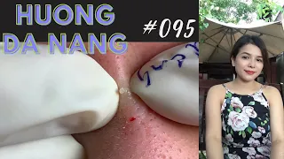 #095 | Huong Da Nang