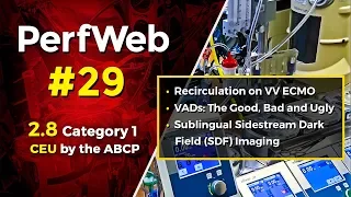 VV ECMO, VADs, and Sublingual incident dark field imaging, Microcirculation and ECMO outcome