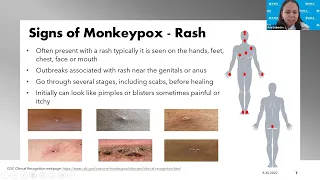Practical Tips for Healthcare Workers During the Current Monkeypox Outbreak