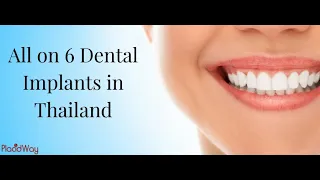 Get Your All on 6 Dental Implants in Thailand