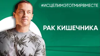 Рак кишечника - Онлайн консультация Артема Толоконина