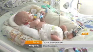 Уникальная операция - в Украине впервые исправили порок сердца малышу весом 1 кг