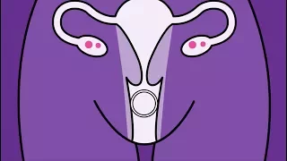 Brook Contraception - Vaginal Ring Animation