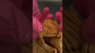 Amazing Muscle Inside a REAL Human Heart