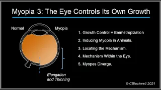 Myopia 3. How the eye controls its own growth: Emmetropization.