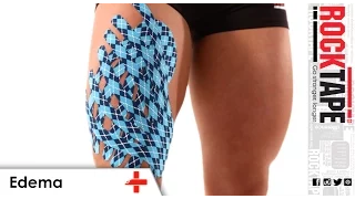 RockTape - Kinesiology Tape Instruction - Edema