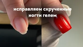 ИСПРАВЛЯМ СКРУЧЕННЫЕ НОГТИ !