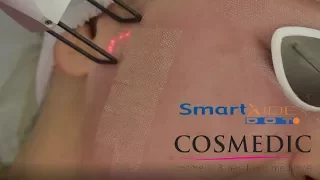 Cosmedic SmartXide Dot