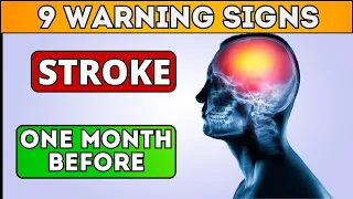 These 9 Warning Signs of Stroke One Month Before – Don't Ignore Them