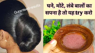 गंजापन, alopecia या समय से पहले सफेद हो रहे बालों के लिए इससे अच्छा और effective उपाय नहीं मिलेगा