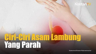 Jangan Diremehkan, Ciri Ciri Asam Lambung yang Parah