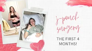 My J pouch Surgery - FIRST 4 MONTHS