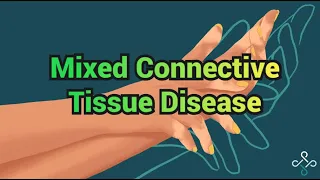 Mixed Connective Tissue Disease - CRASH! Medical Review Series