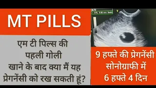 MT pills की 5 गोलियों में से पहली गोली खाने के बाद क्या मैं प्रेगनेंसी को रख सकती हूं ?  MT PILLS