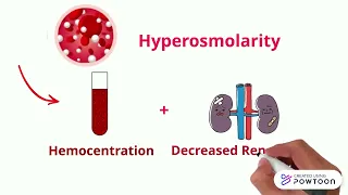 8 Hemoconcentration