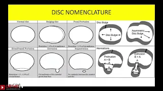 Lecture Imaging the degenerative lumbar spine   Gurudip Das